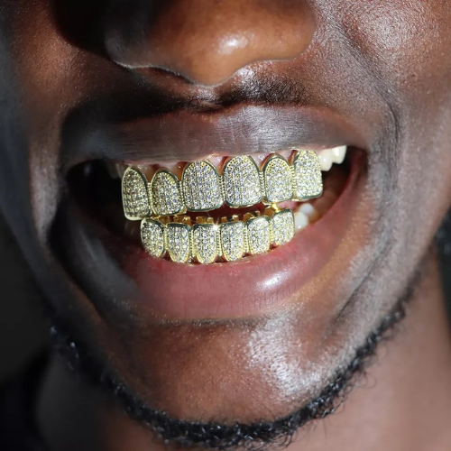 Gold Iced Out Grillz